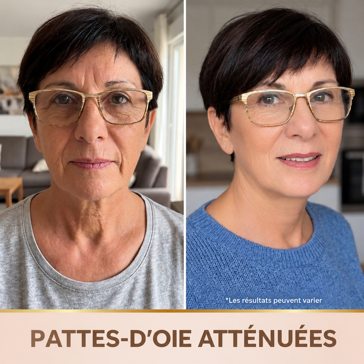 Colynes – Sérum coréen, effet lifting dès la première application.