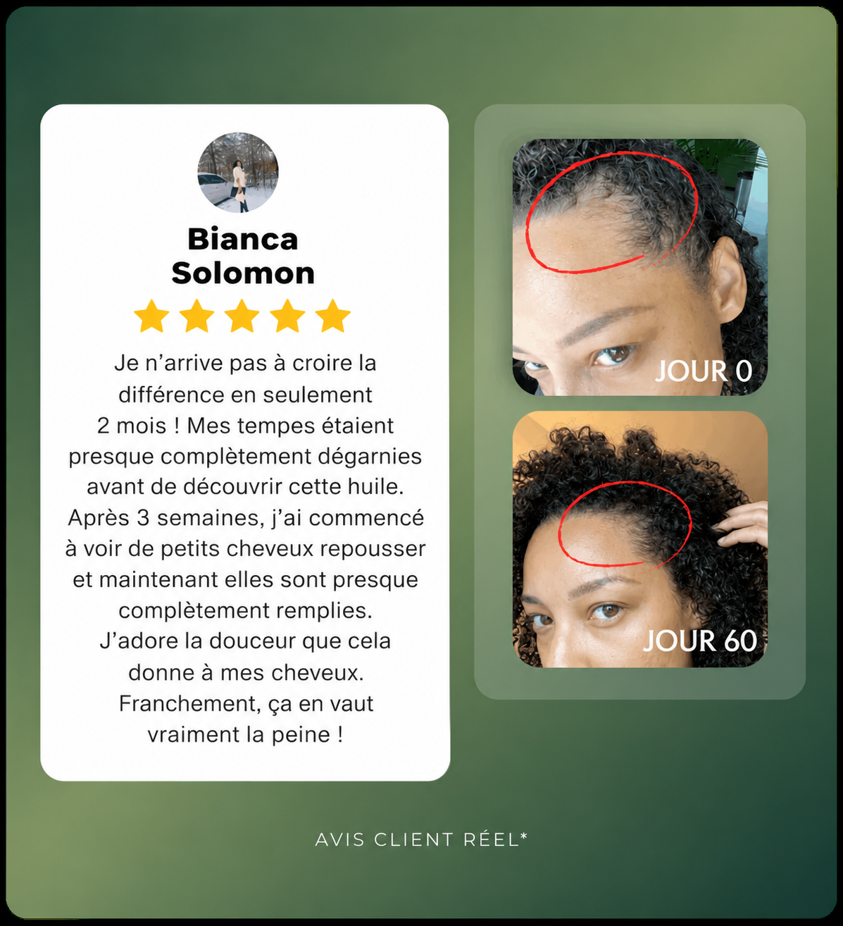 Huile capillaire naturelle Batana
