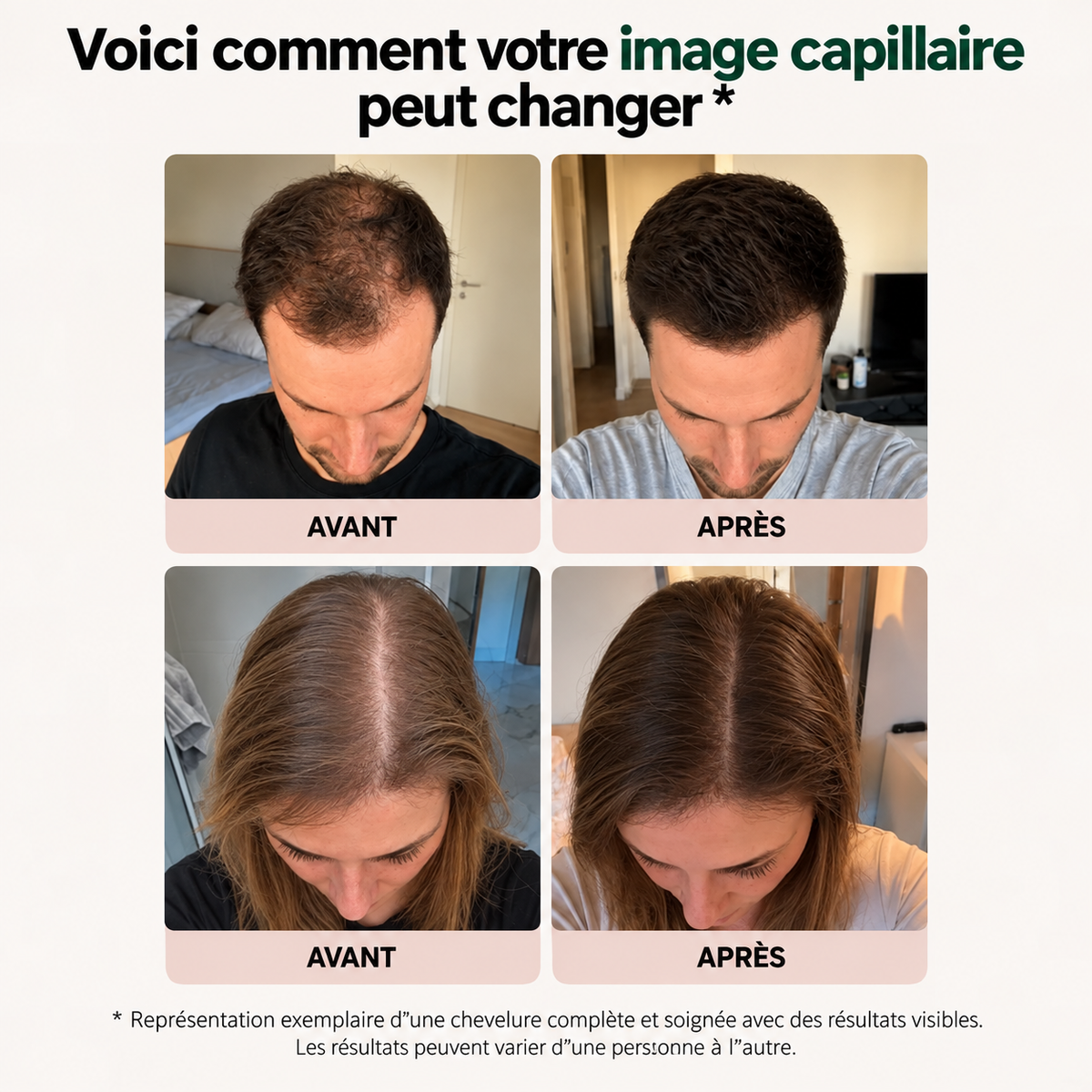 [Pack] Croissance cheveux BIO Premium+