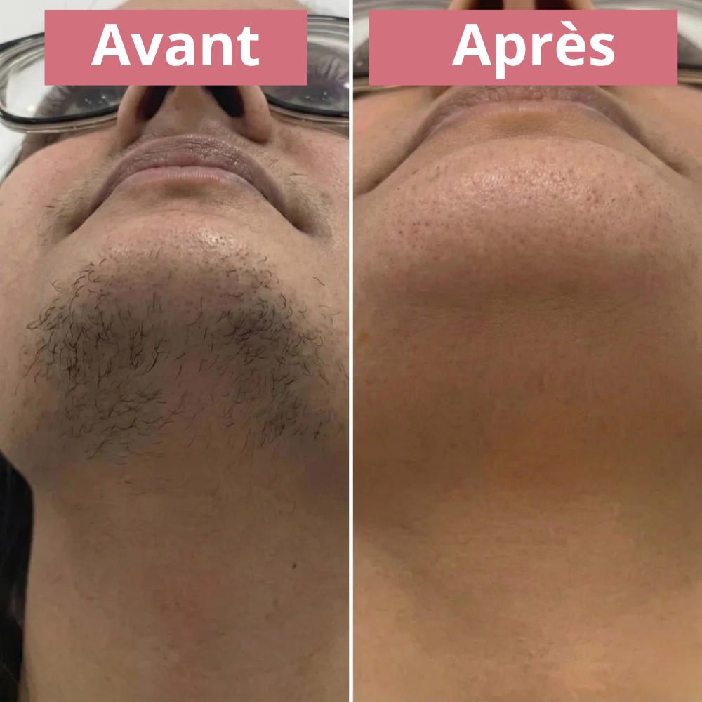 Inhibiteur de croissance d'origine végétal