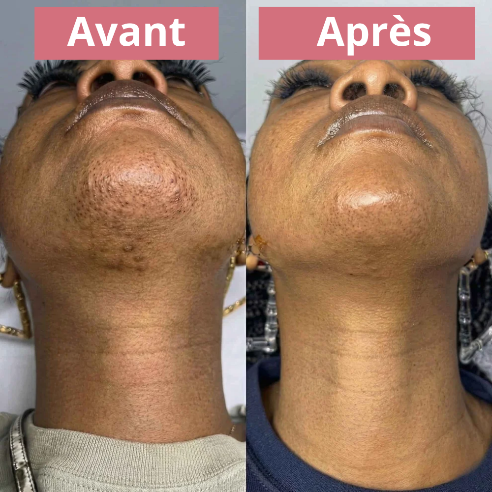 Inhibiteur de croissance d'origine végétal